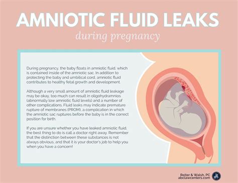 does amniotic fluid leak|Amniotic Fluid: What is It and Signs of Leaking